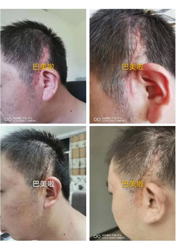 皮肤护理产品资料图